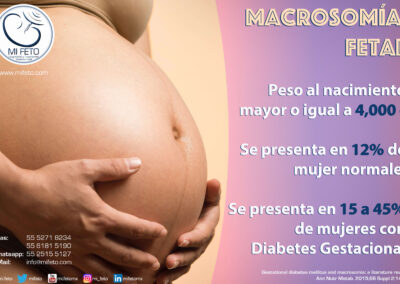 Macrosomia Fetal