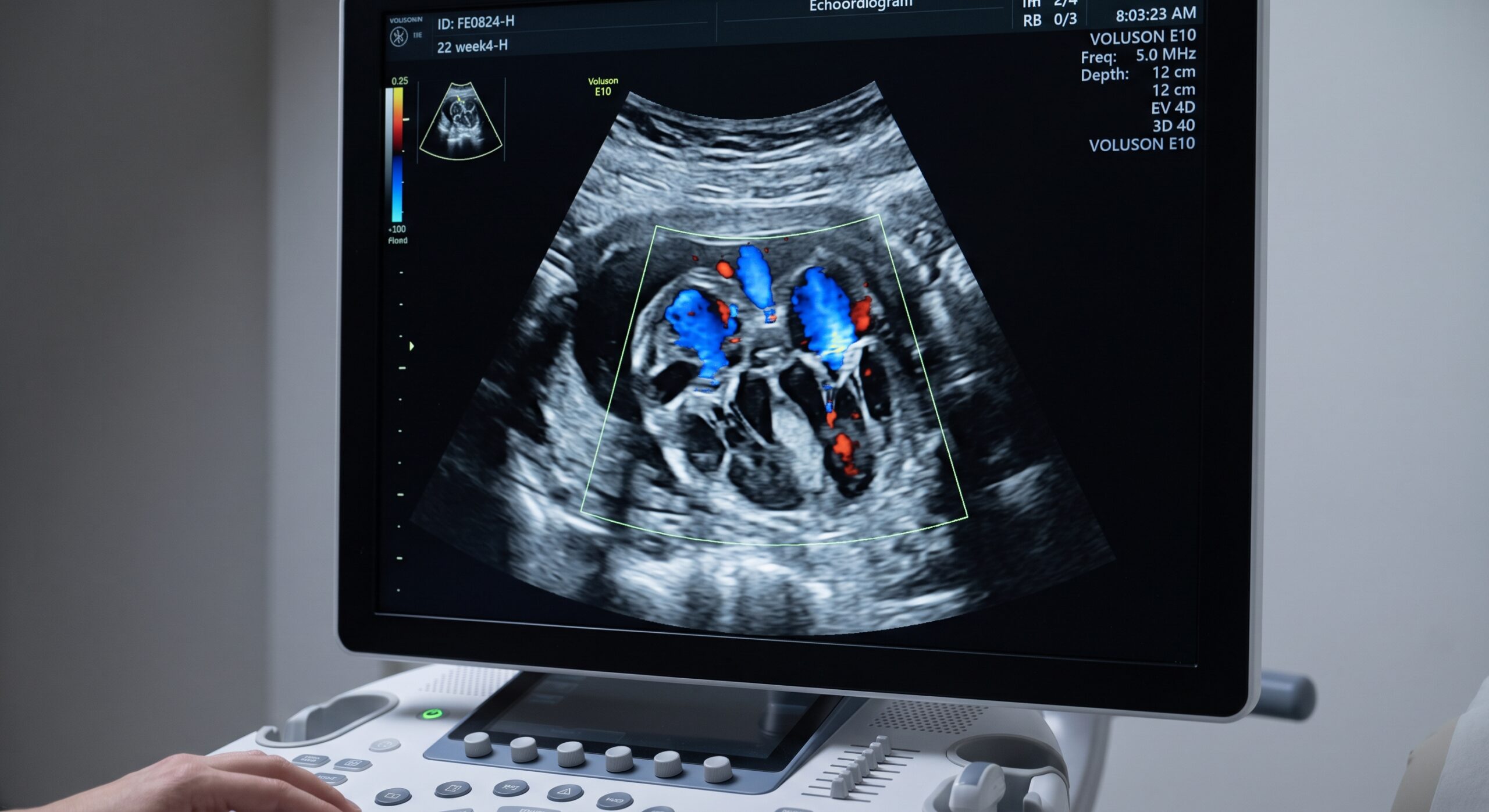 Cardiologia Fetal